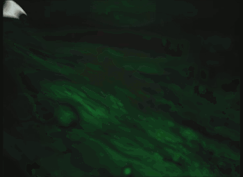 green and white blobs